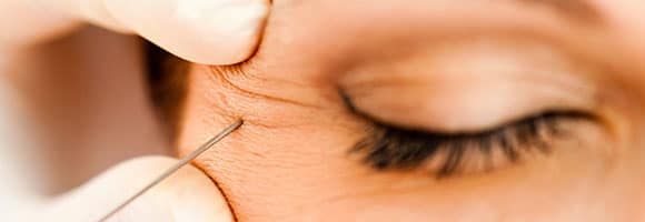closeup of botox needle being injected near patient’s eye