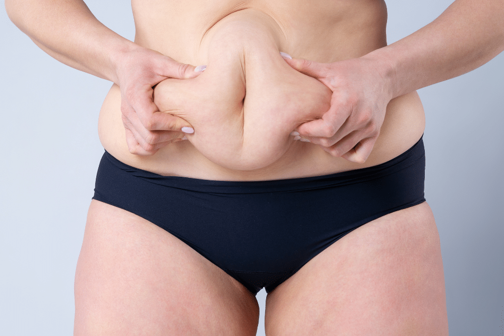 Liposuction & Tummy Tuck Surgery---Can I Combine Both Procedures