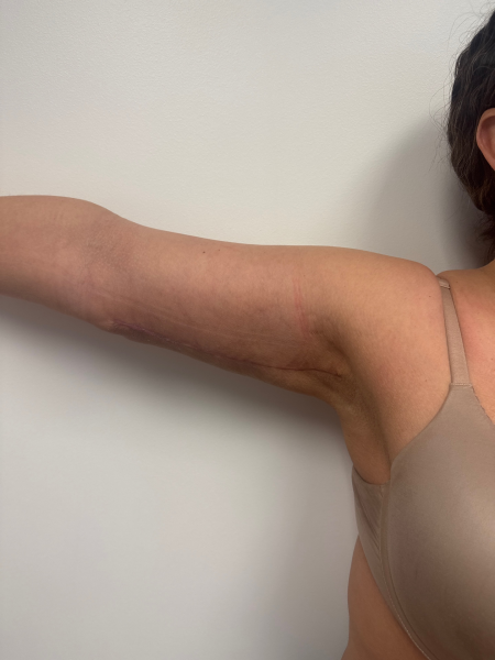 After Image: After Weight Loss - front