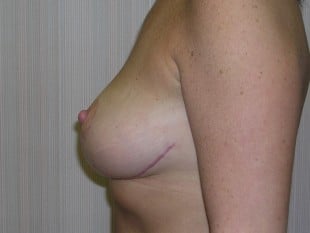 After Image