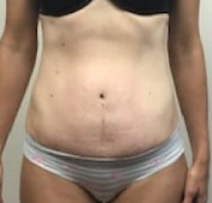After Image